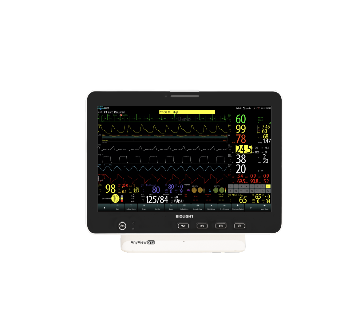 Moniteur G15